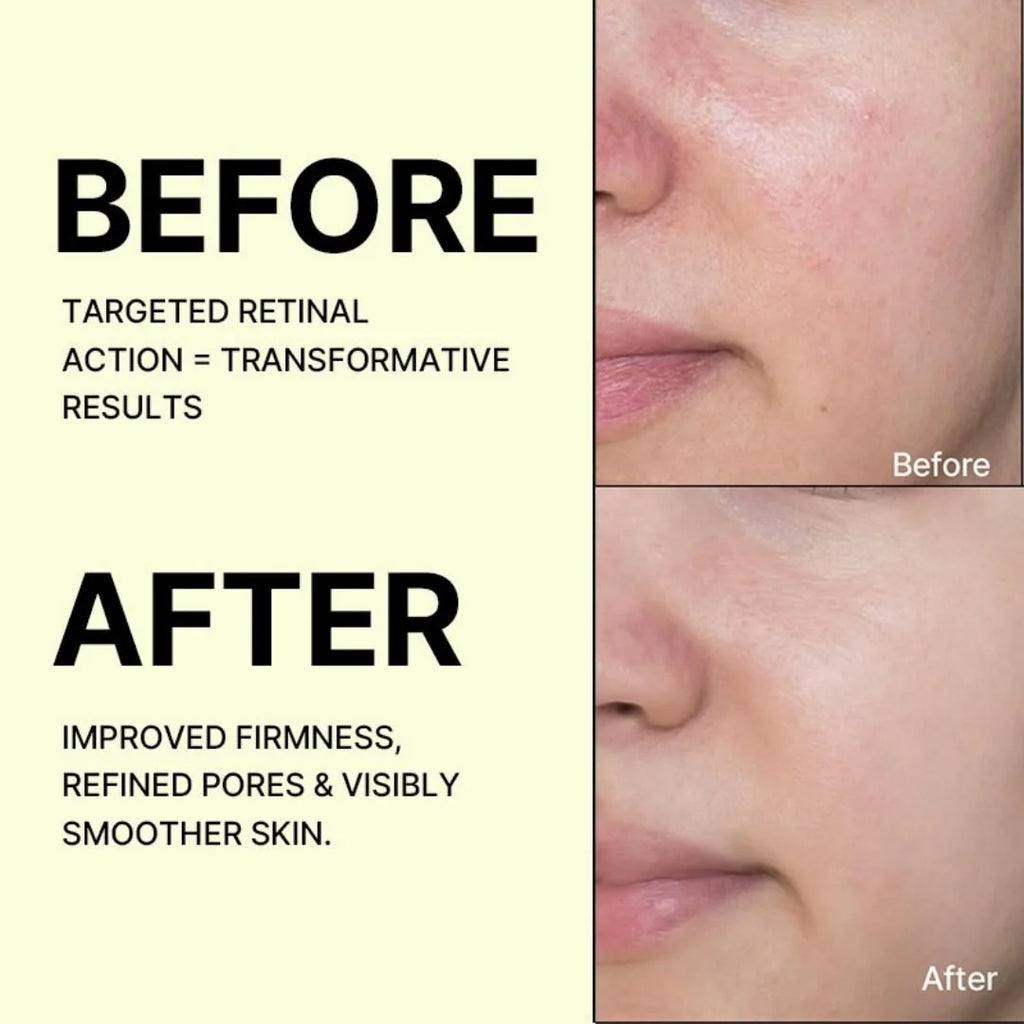 Celimax The Vita A Retinol Shot Tightening Booster