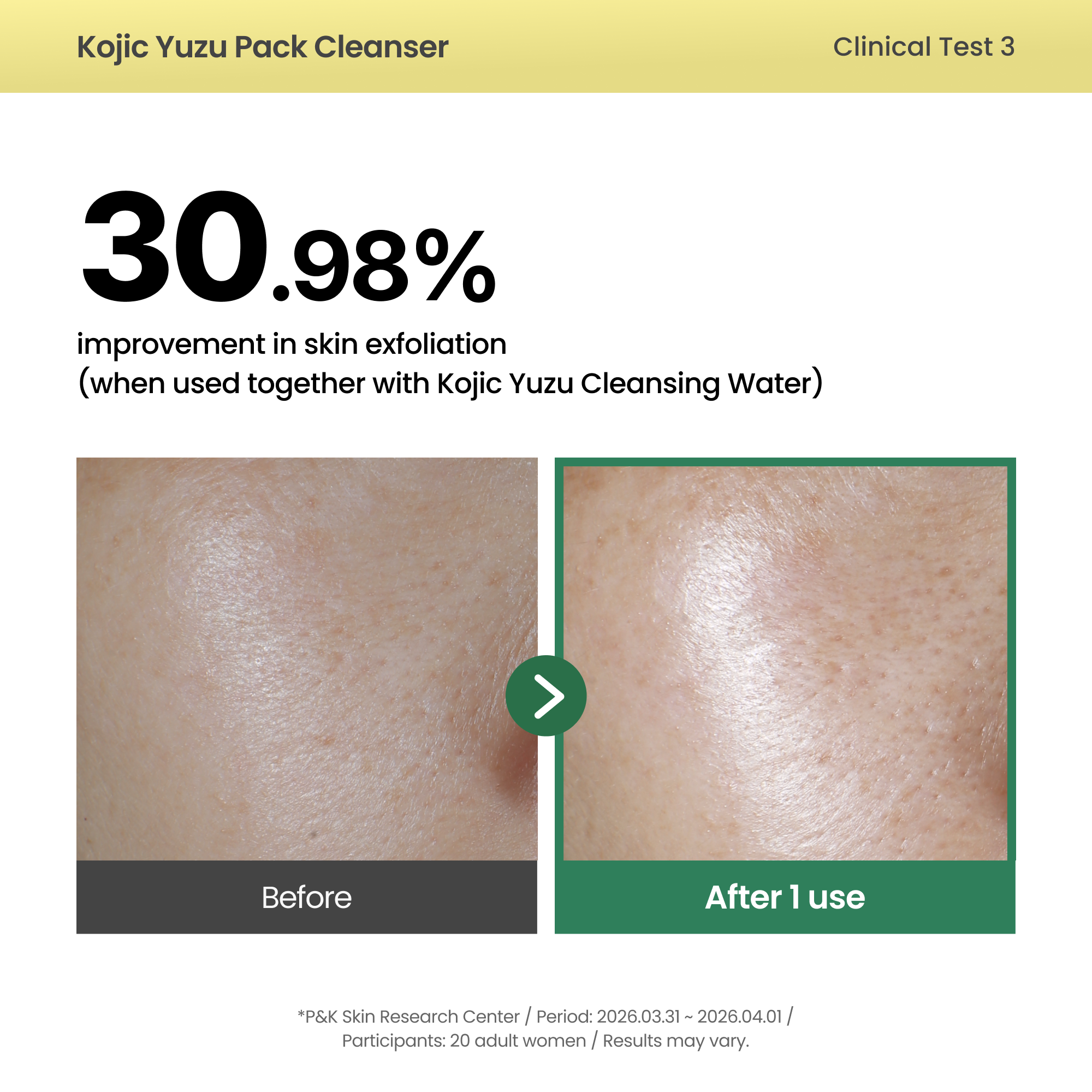 Axis-Y Kojic Yuzu Pack Cleanser (60g)